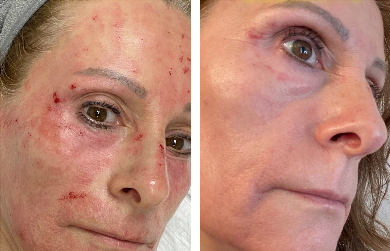 Die Haut, unser grösstes Organ